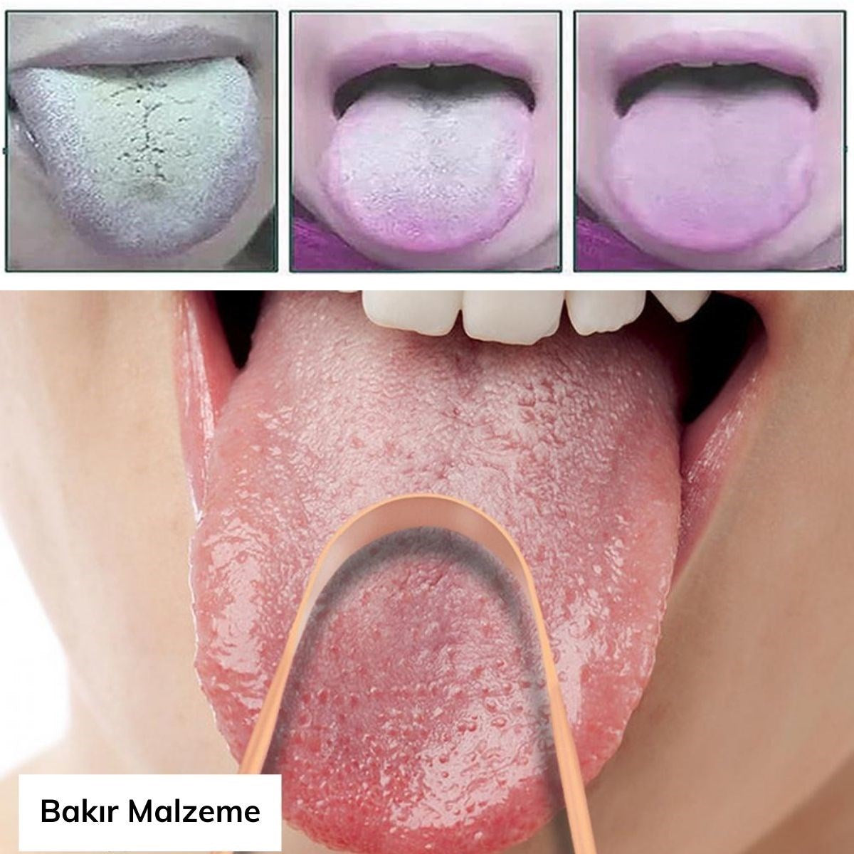 ANKAVERSE® Bakır Oil Pulling Yağ Çekme Dil Plak Temizleme Aleti Dil Fırçası Sıyırıcı Dil Kaşığı